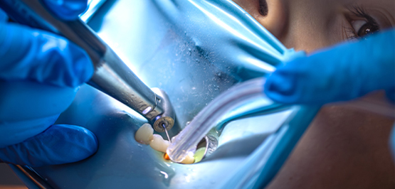 Tandl&auml;kare estetisk behandling sollentuna