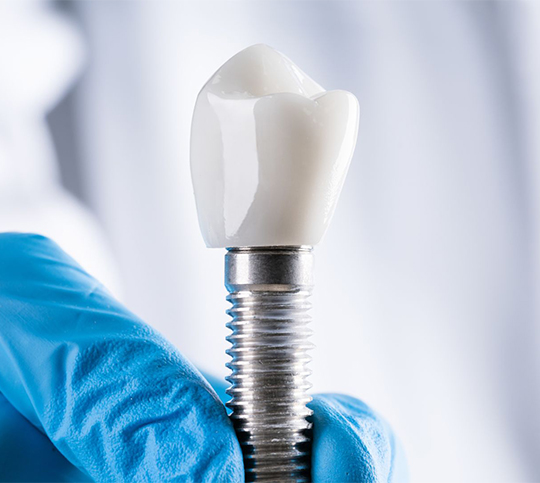 Implantat-naturligt-resultat Implantat-naturligt-resultat