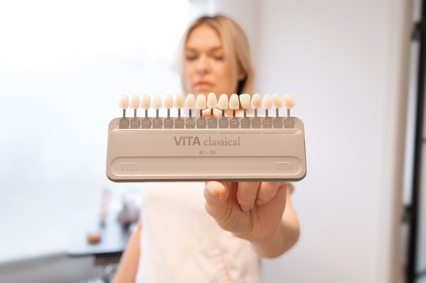 Implantat-naturligt-resultat